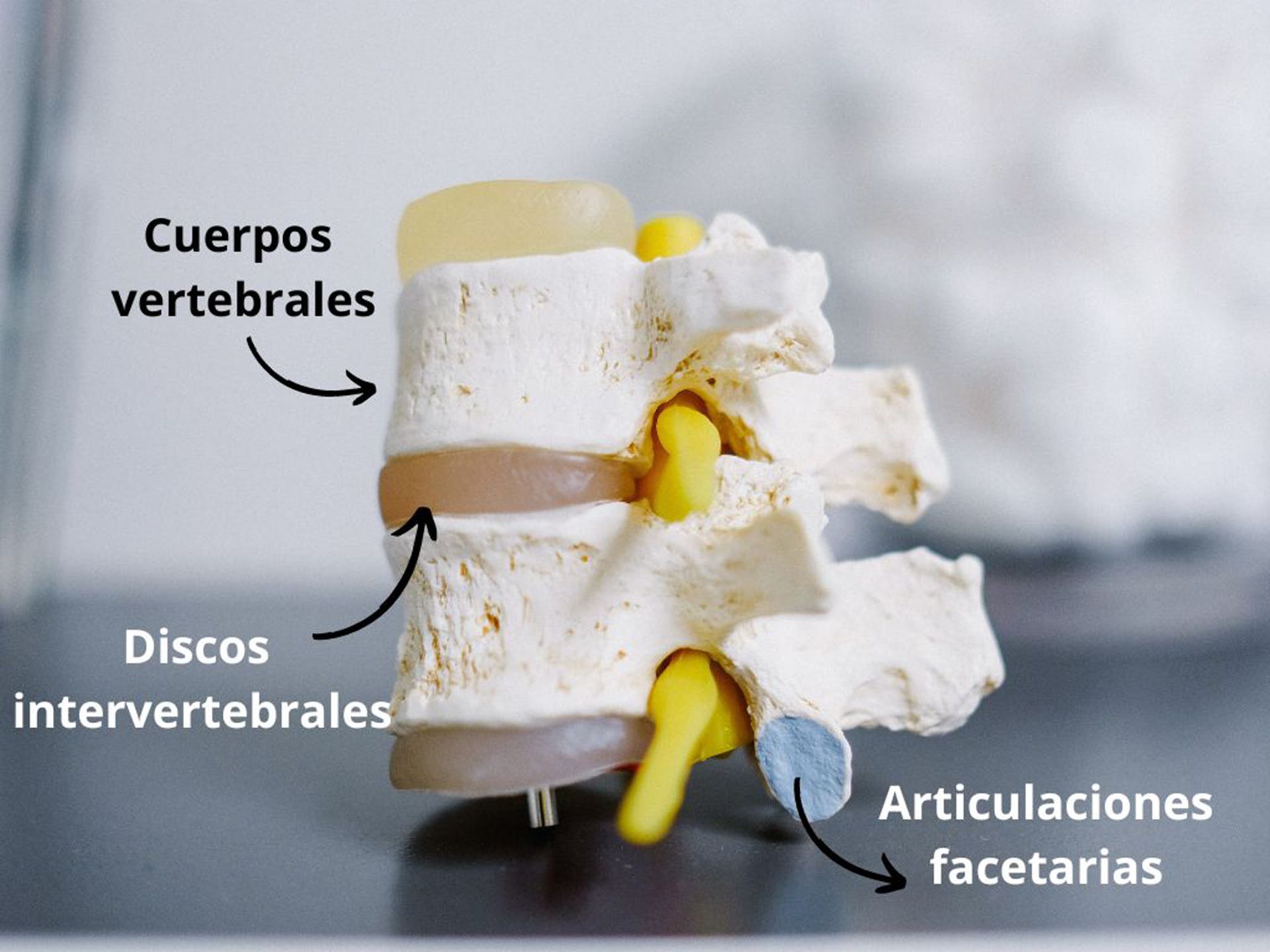 cuerposvertebrales-dolorespalda